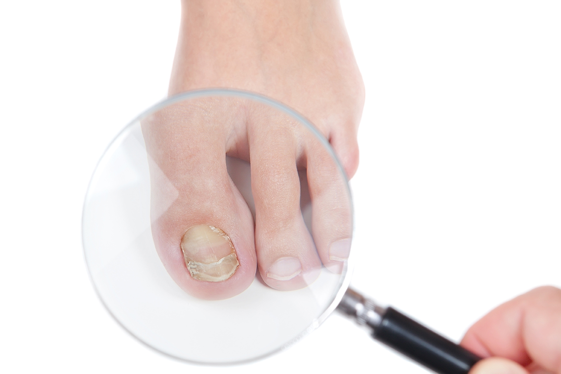​8 diseases that white spots on your nails indicate | Times of India