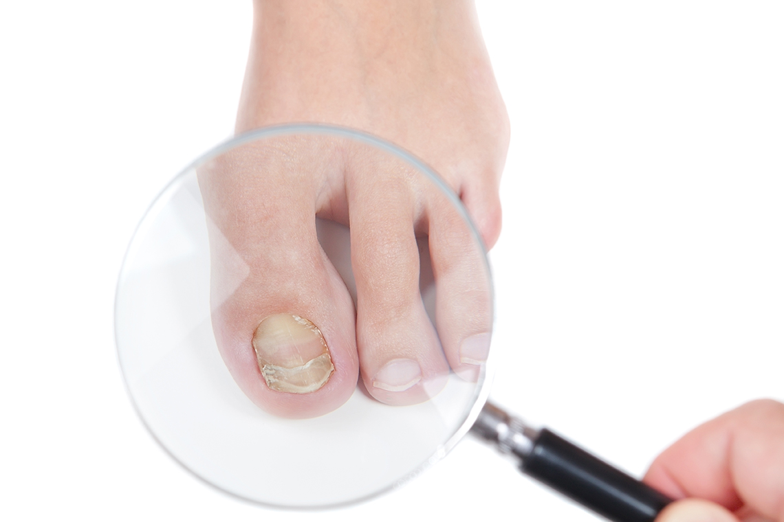 Nail Bed Injury - Surgical Repair - TeachMeSurgery